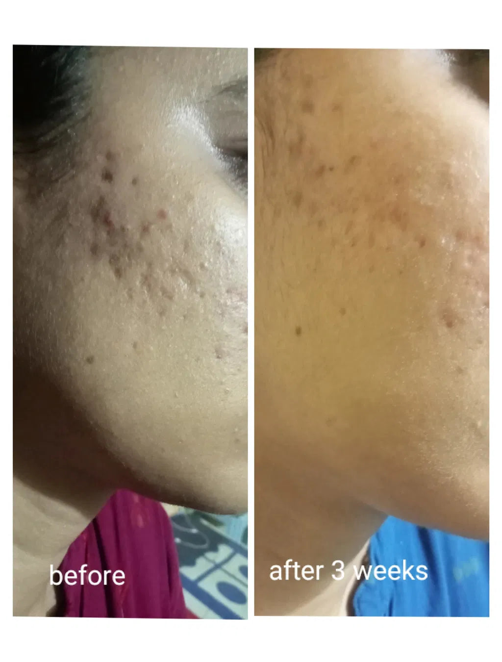 LUMERA Whitening Serum