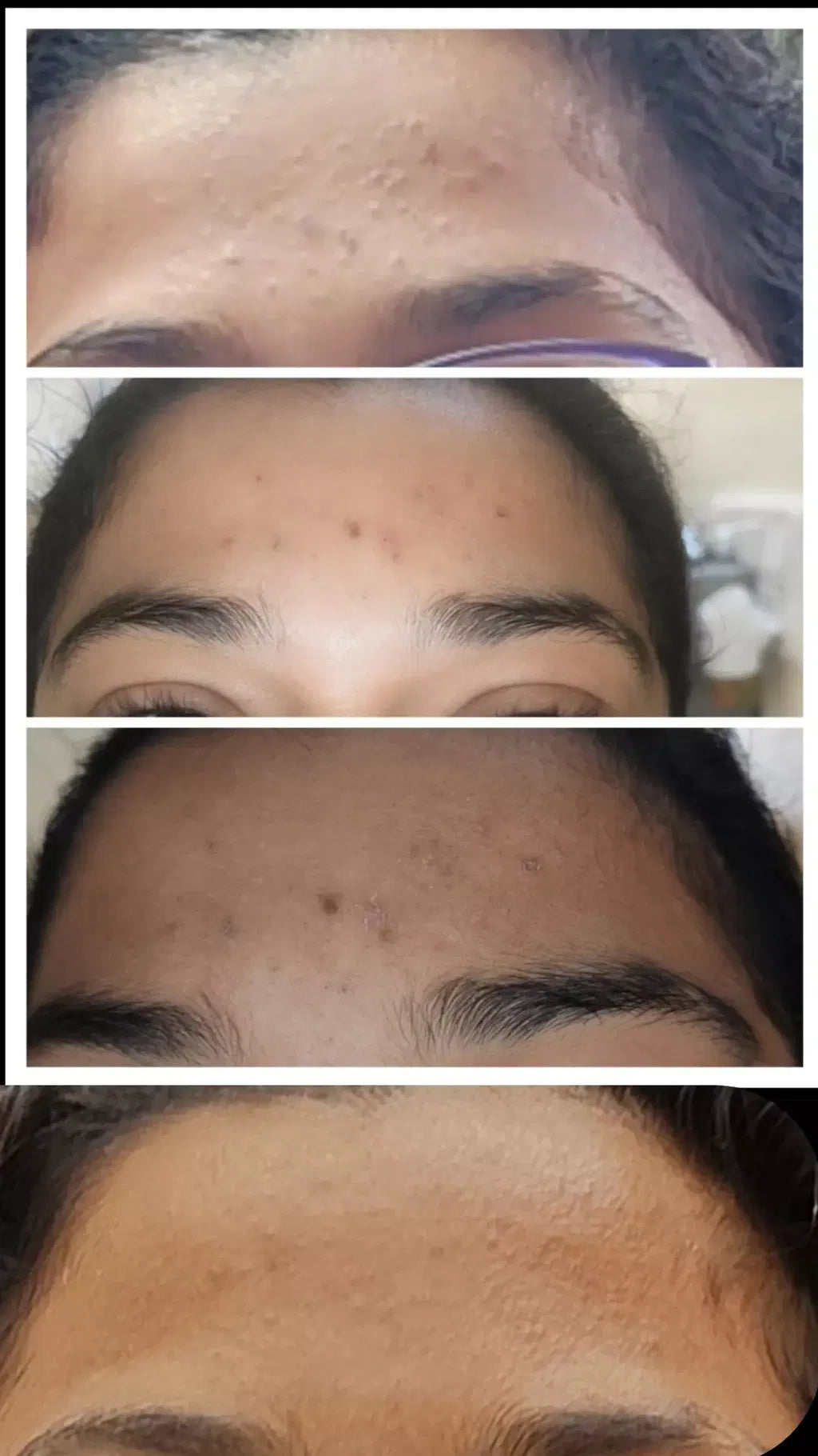 LUMERA Whitening Serum