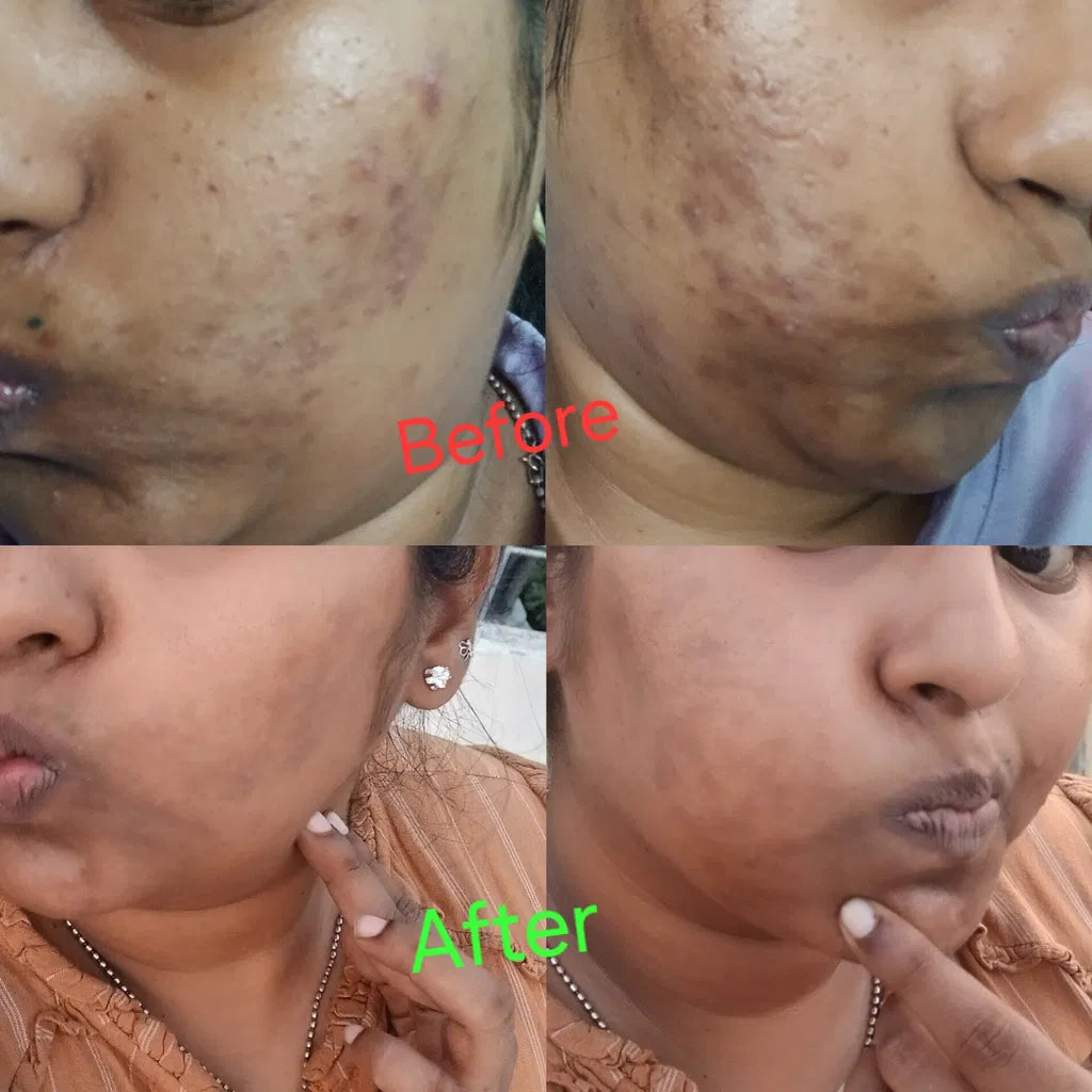LUMERA Whitening Serum