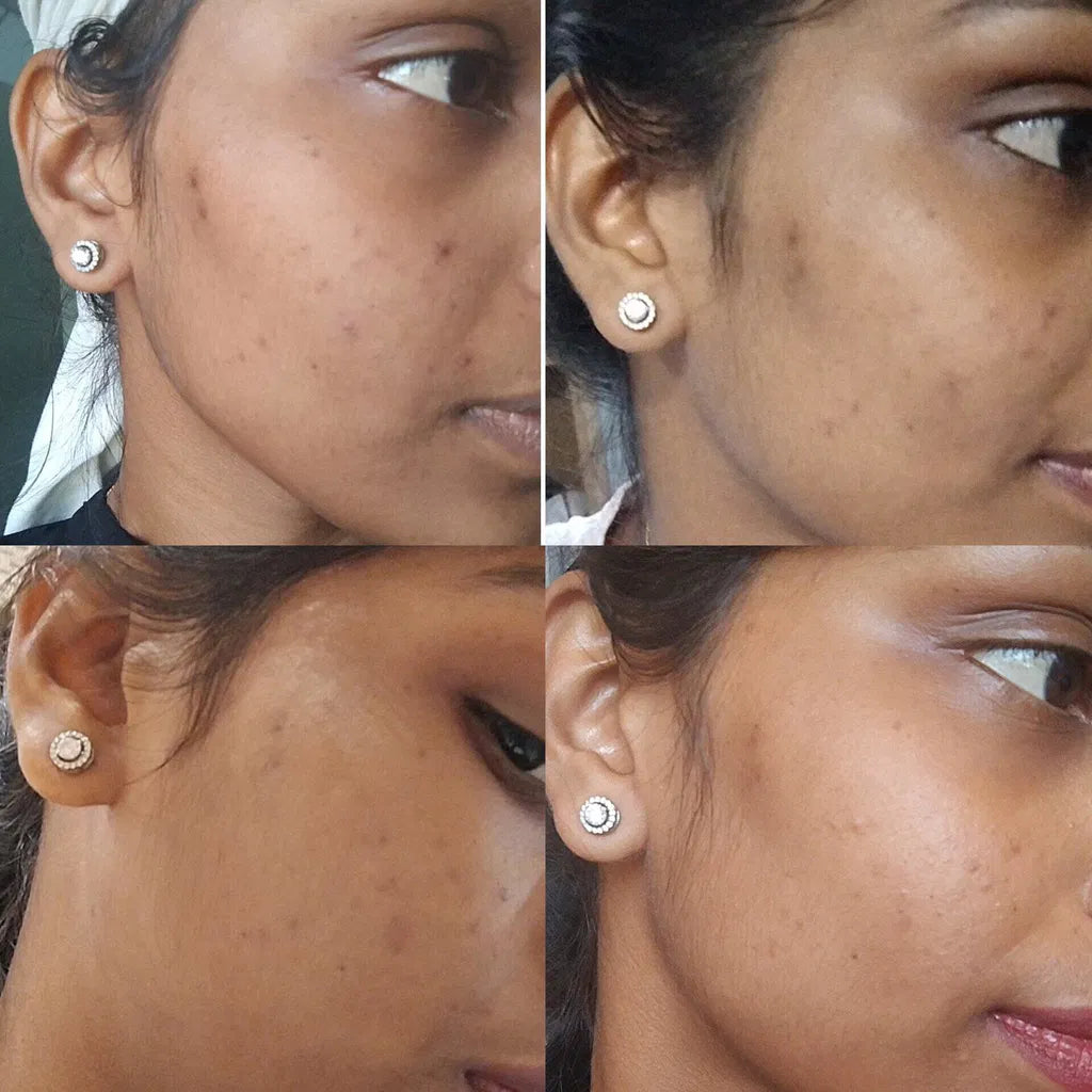 LUMERA Whitening Serum