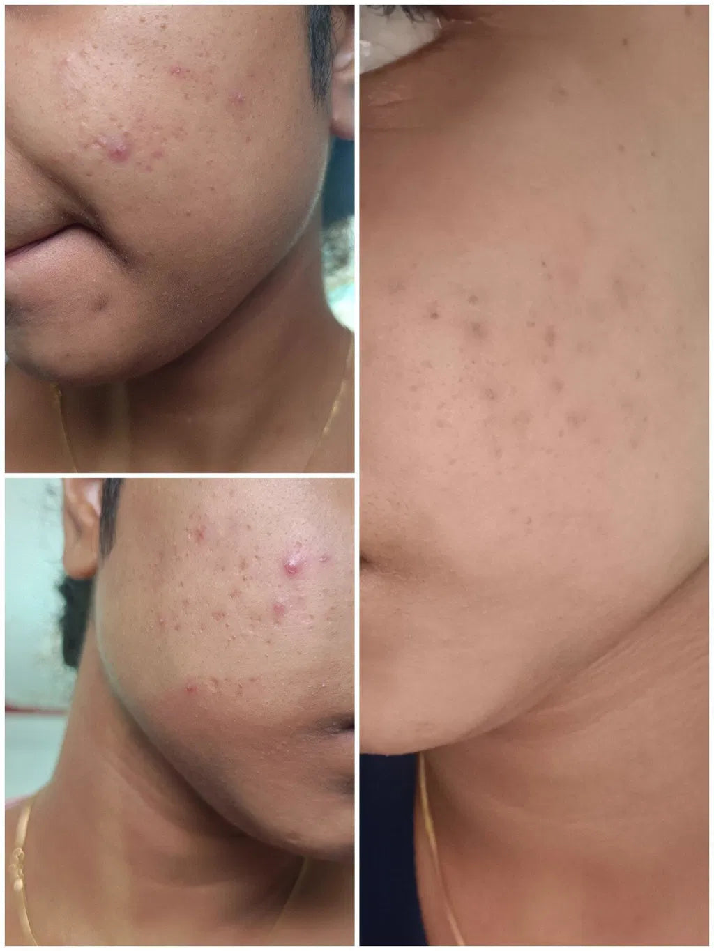 LUMERA Whitening Serum
