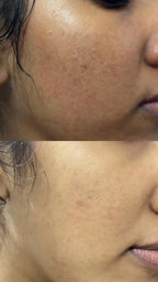 LUMERA Whitening Serum