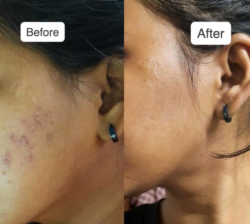 LUMERA Whitening Serum