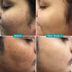 LUMERA Whitening Serum