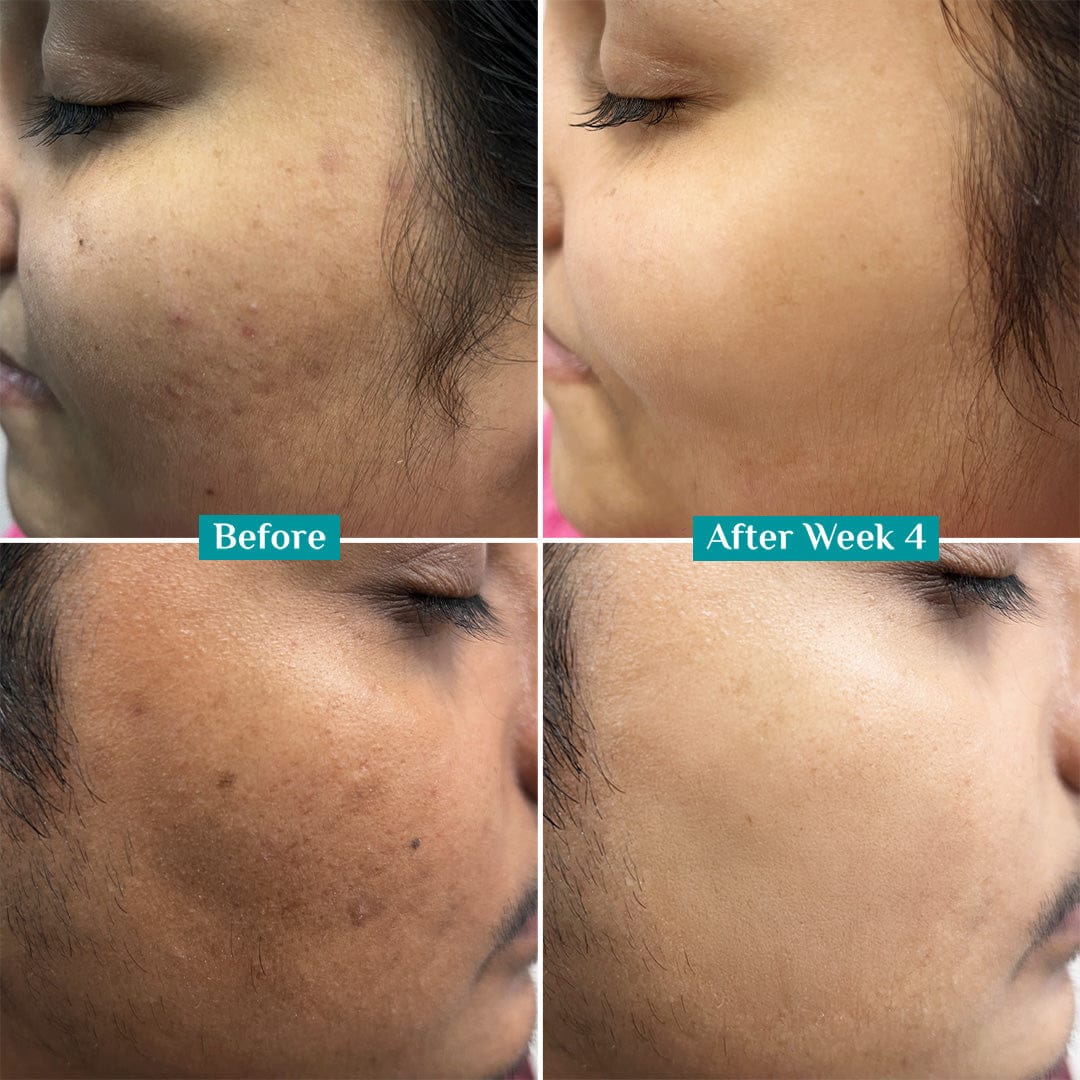 LUMERA Whitening Serum