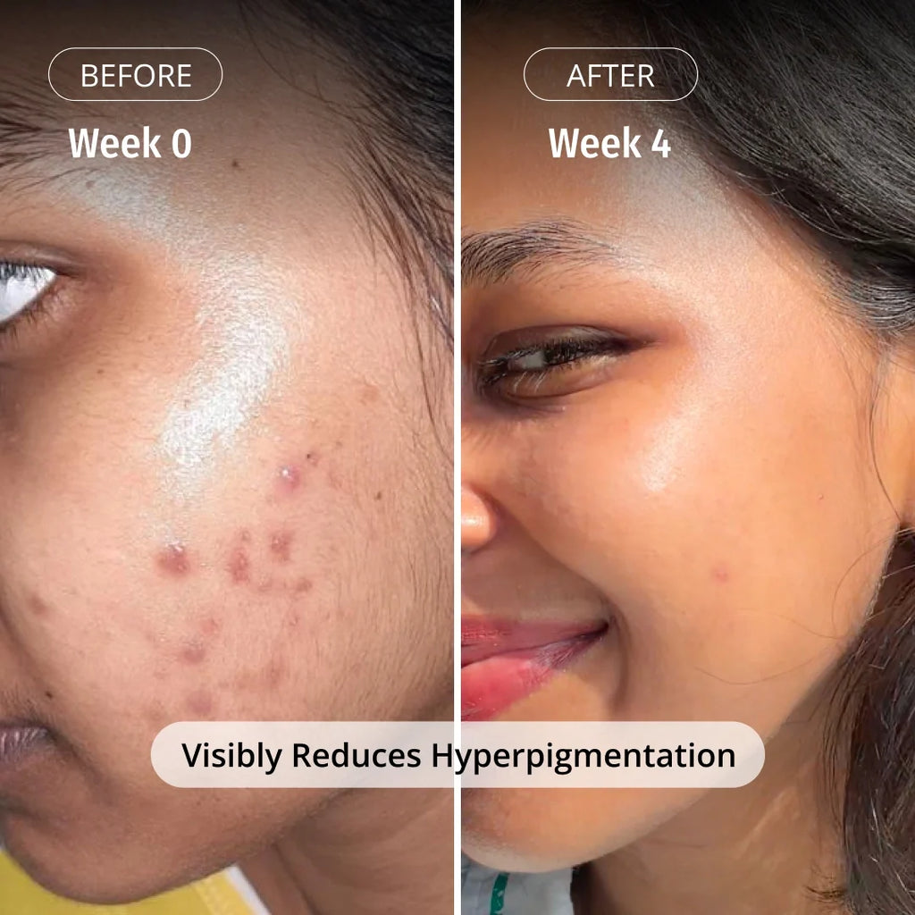 LUMERA Whitening Serum