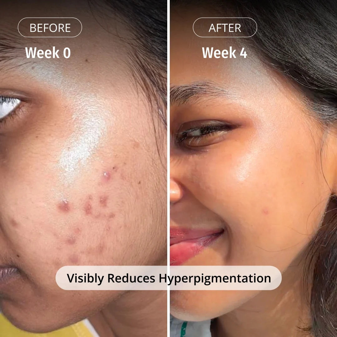 LUMERA Whitening Serum