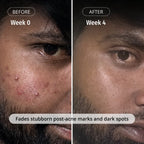 LUMERA Whitening Serum