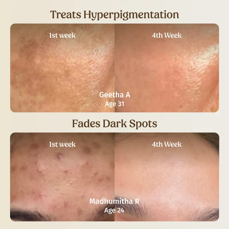LUMERA Whitening Serum