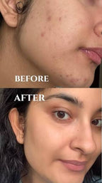 LUMERA Whitening Serum